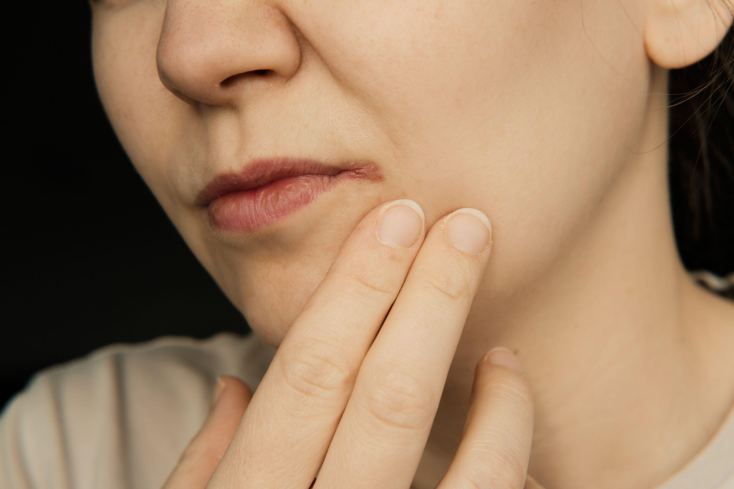 شناخت علائم برفک دهان (عفونت دهان) برای درمان سریع