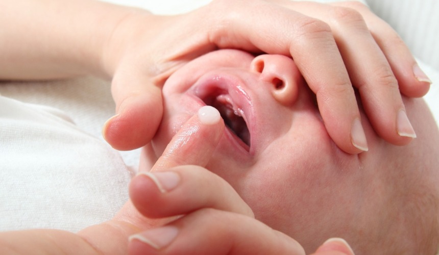 برفک دهان نوزاد چیست؟