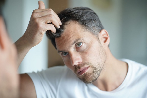 پیشگیری از ریزش مو در آقایان