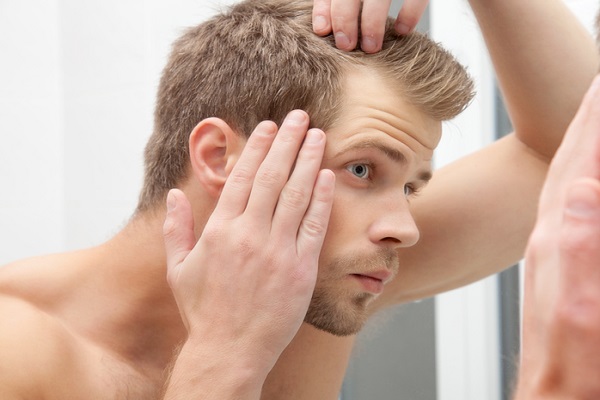 ریزش جلوی موی سر : راهنمای جامع 6 علت،  درمان و پیشگیری از آلوپسی