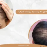 چگونه موهای کم پشت را پرپشت کنیم؟ / ۱۰ روش تاثیرگذار