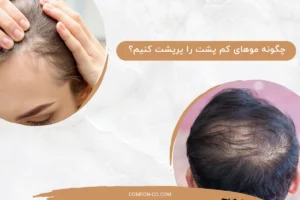 چگونه موهای کم پشت را پرپشت کنیم؟ / ۱۰ روش تاثیرگذار