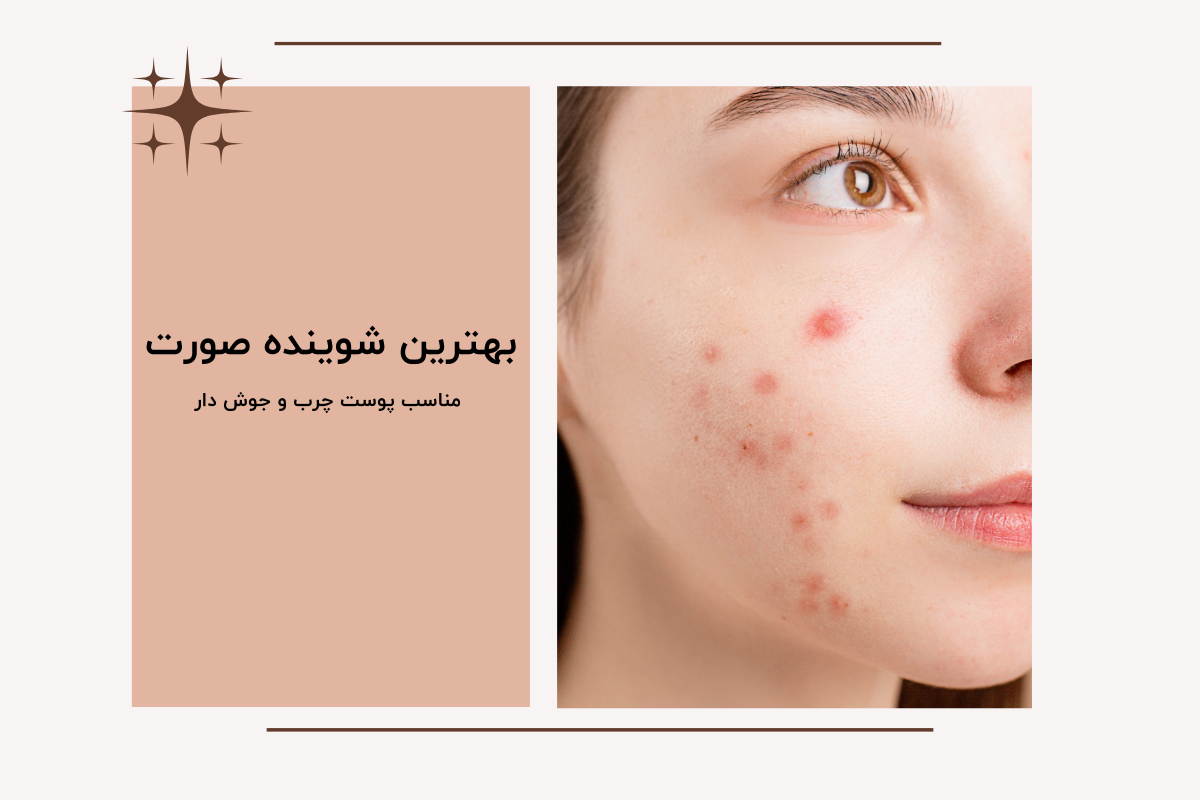 بهترین شوینده صورت مناسب پوست چرب و جوش دار