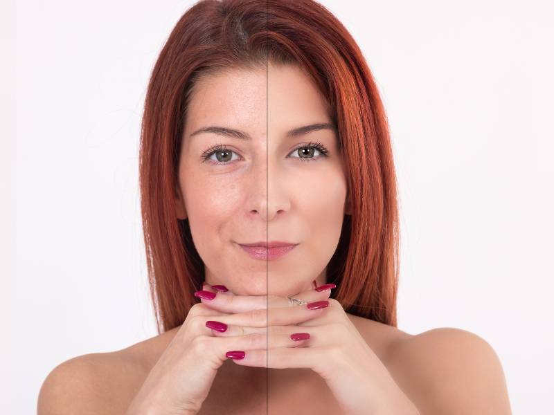 سفت شدن پوست