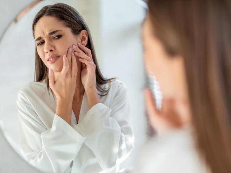 انواع جوش زیر پوستی