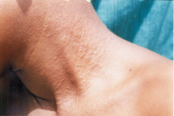 دون دون شدن پوست