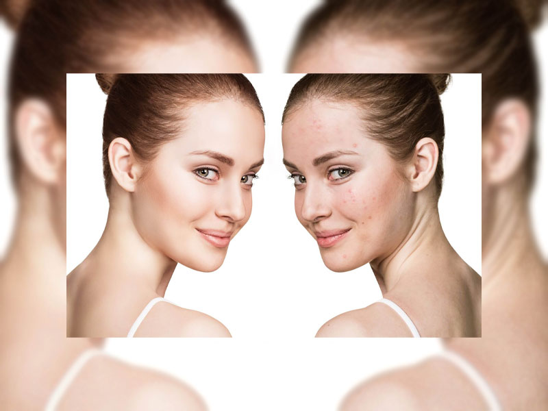 تغذیه و جوش