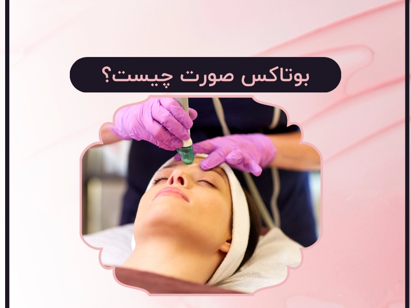 بوتاکس صورت چیست؟