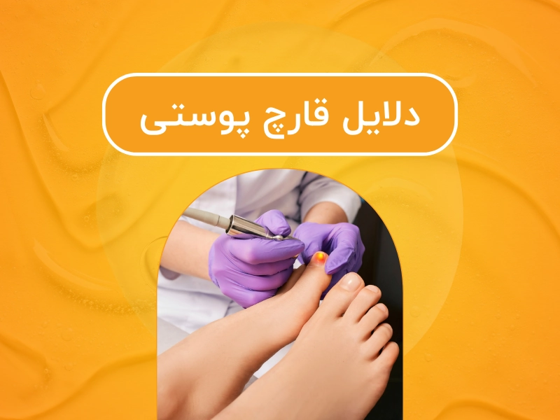 دلایل قارچ پوستی