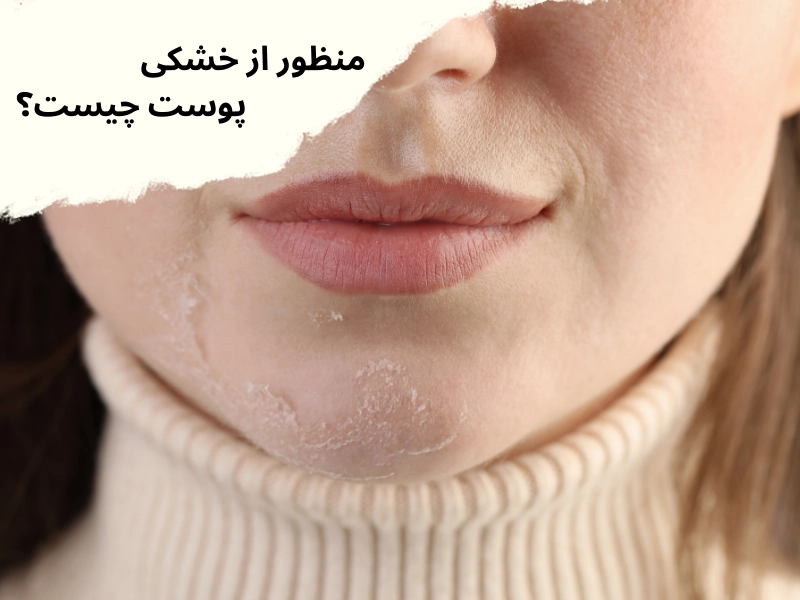 منظور از خشکی پوست چیست؟