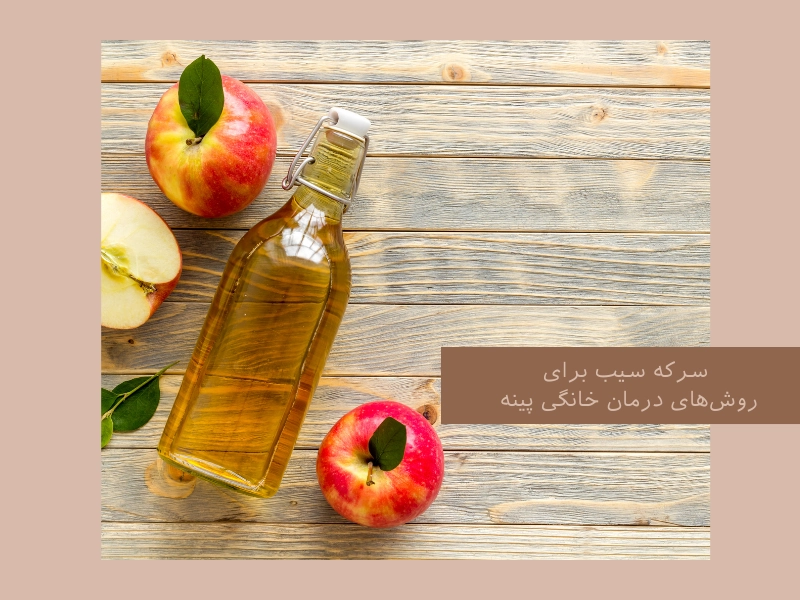 روشهای درمان خانگی پینه