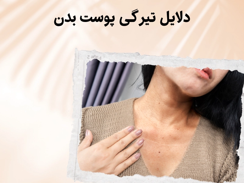 دلایل تیرگی پوست بدن