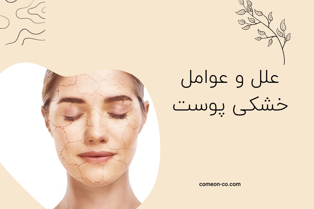 علل و عوامل خشکی پوست + درمان معجزه آسا
