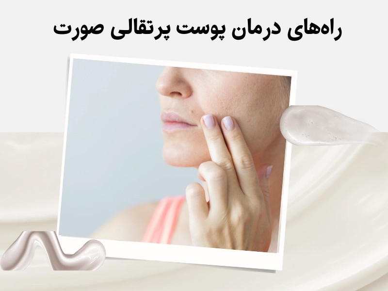 راه‌های درمان پوست پرتقالی صورت