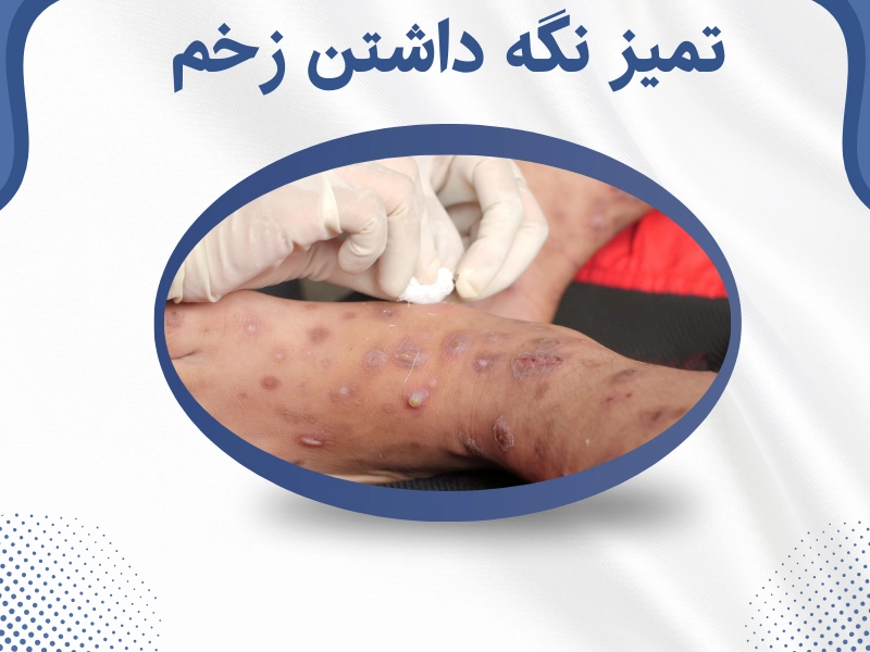 تمیز نگه داشتن زخم