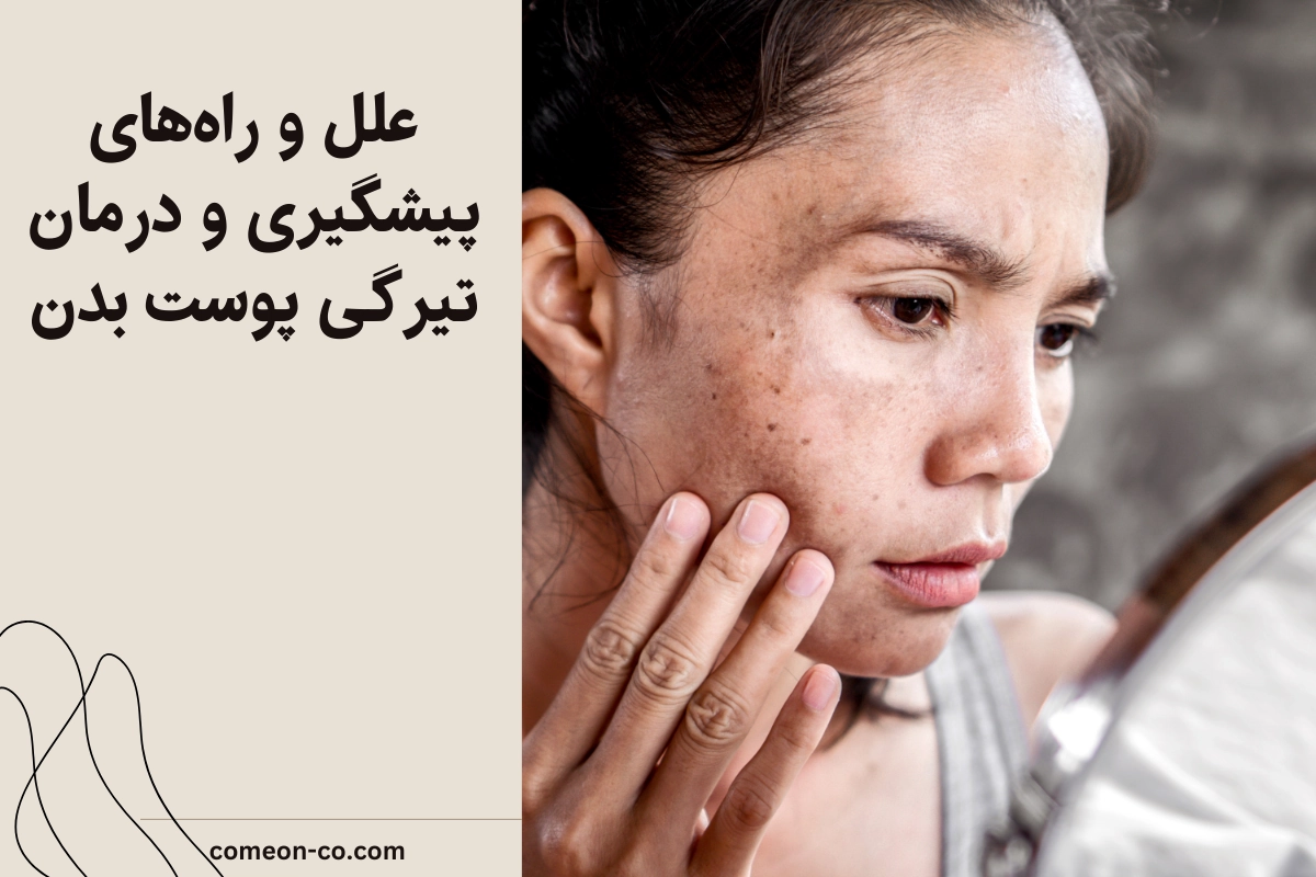 علل و راههای پیشگیری و درمان تیرگی پوست بدن