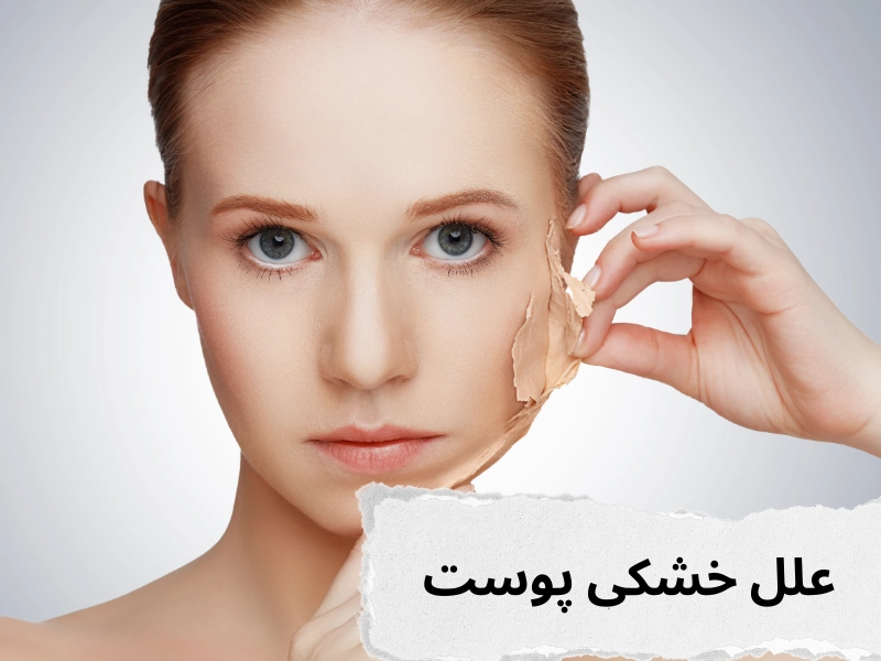 علل خشکی پوست