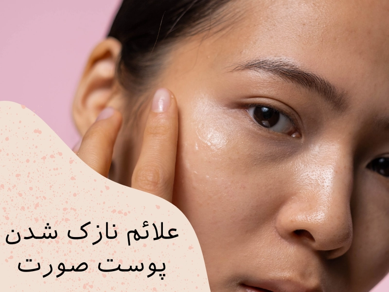 علائم نازک شدن پوست صورت