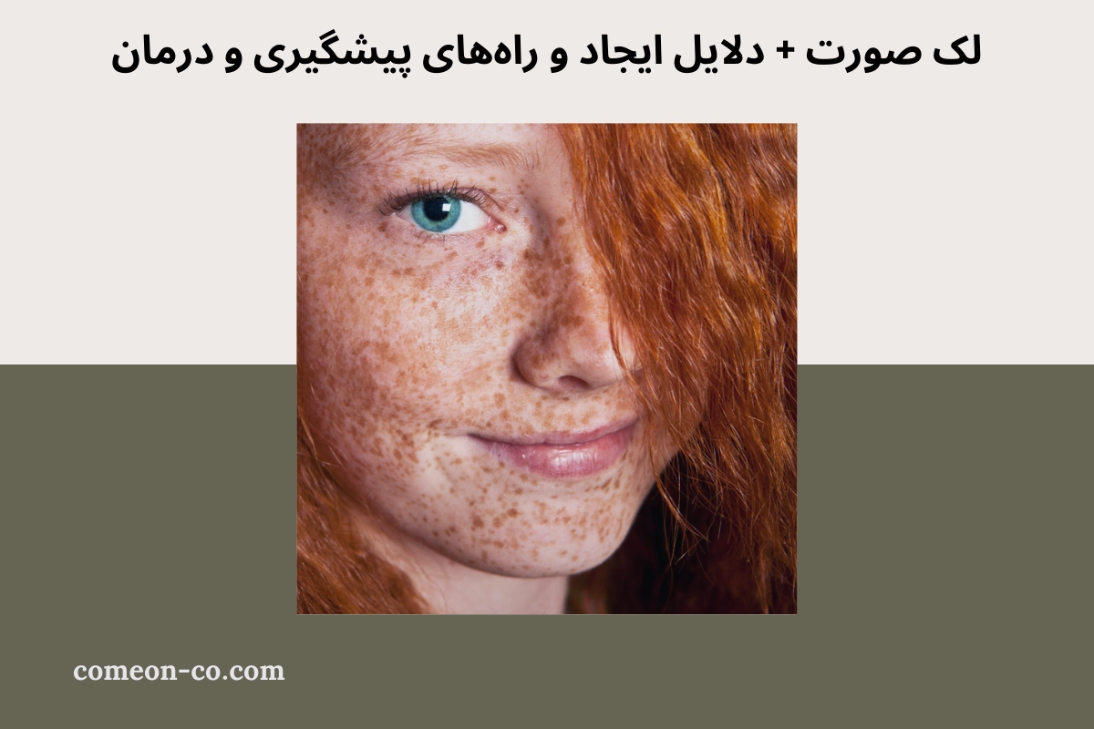 لک صورت + دلایل ایجاد و راههای پیشگیری و درمان