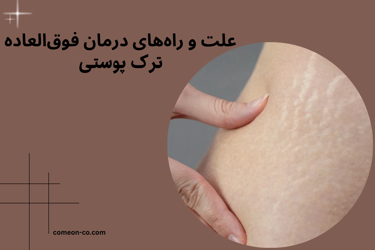 علت و راههای درمان فوقالعاده ترک پوستی