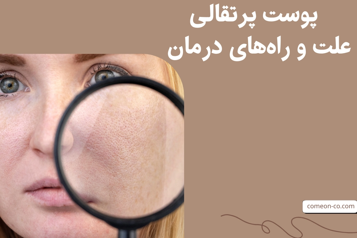پوست پرتقالی