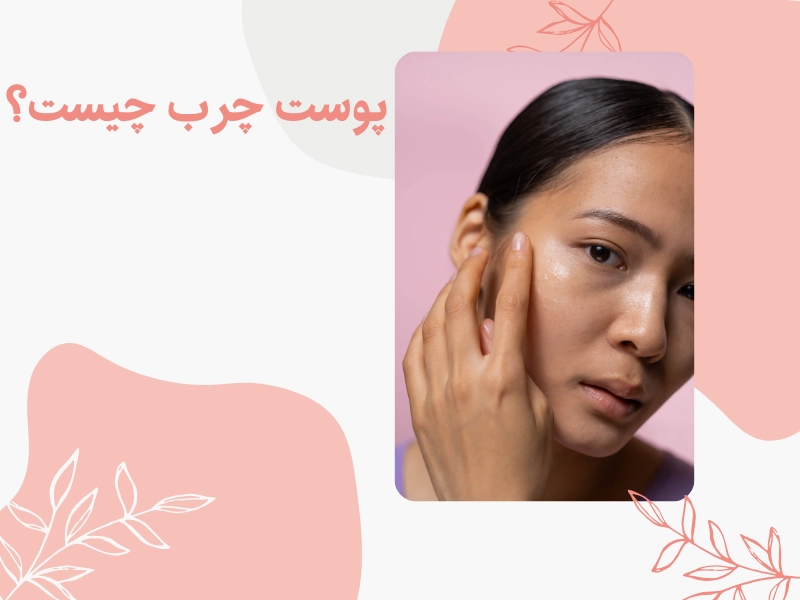 پوست چرب چیست؟