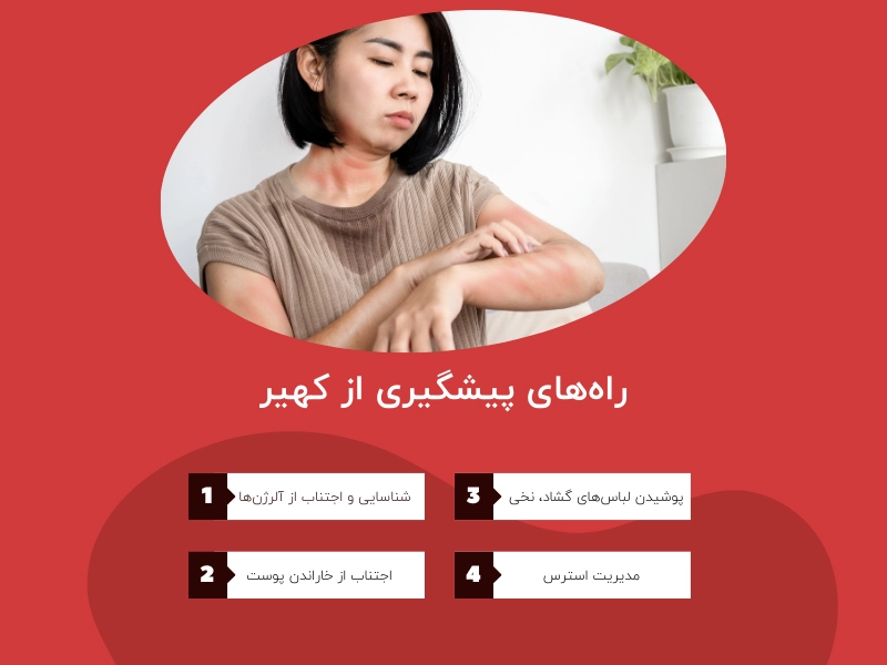 راههای پیشگیری از کهیر