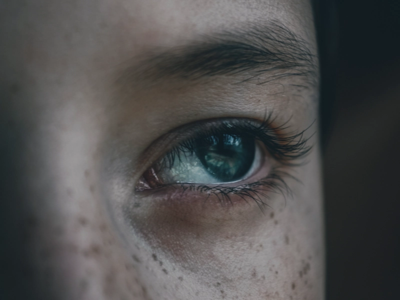 روش های درمان و رفع لکهای صورت کدامند؟