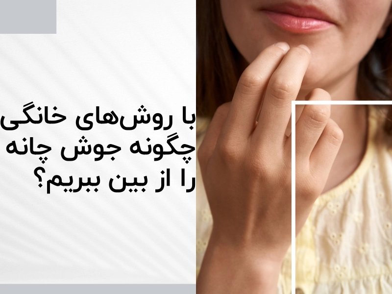 با روش‌های خانگی چگونه جوش چانه را از بین ببریم؟