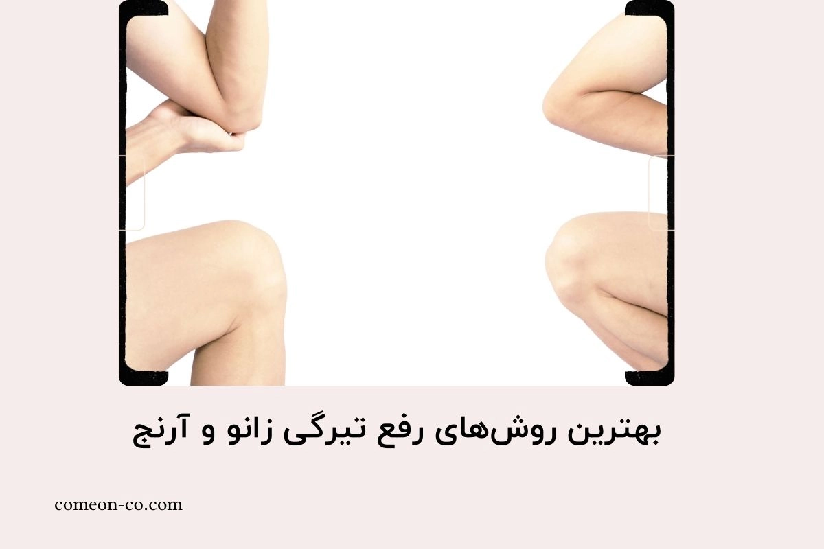 بهترین روشهای رفع تیرگی زانو و آرنج