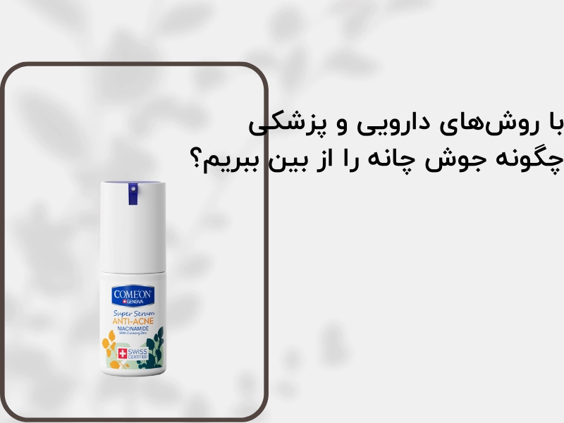 با روش‌های دارویی و پزشکی چگونه جوش چانه را از بین ببریم؟