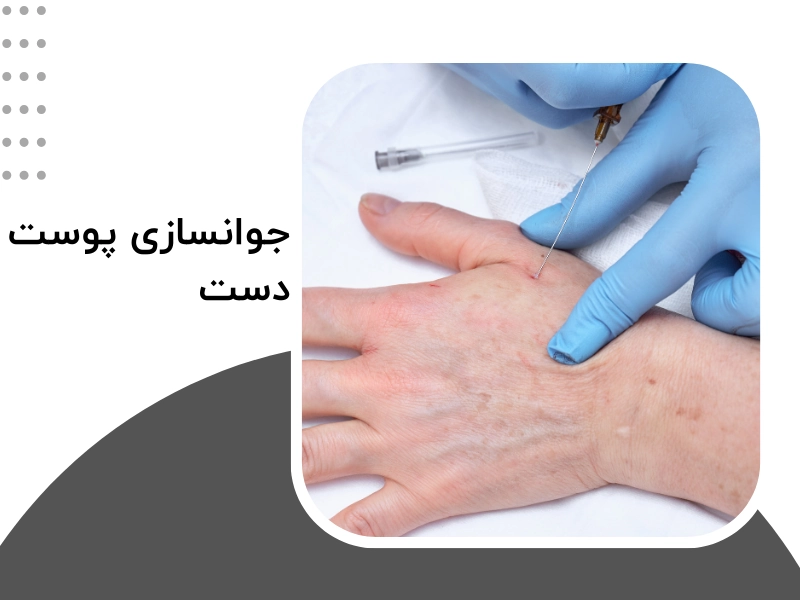 جوانسازی پوست دست