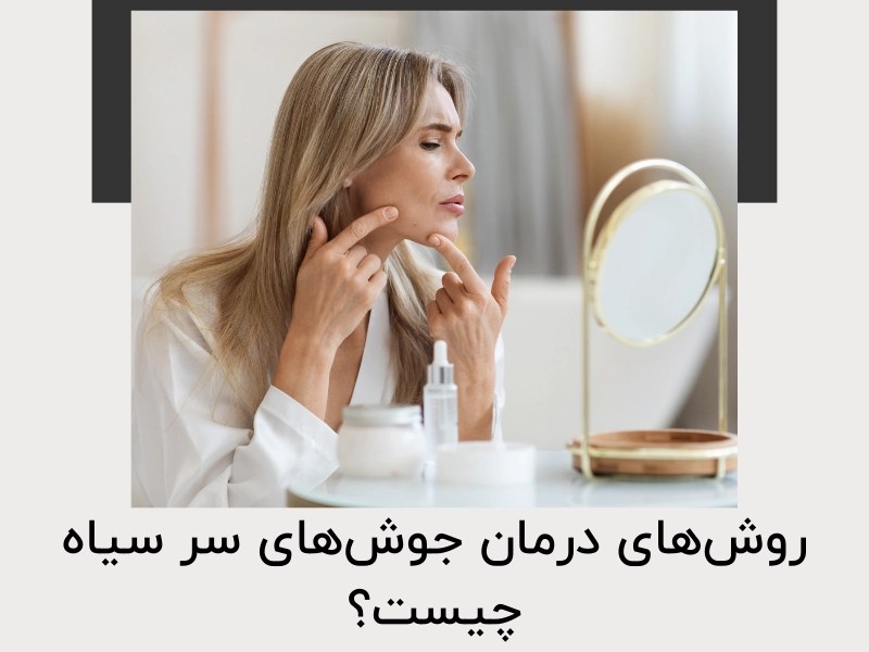 روش‌های درمان جوش‌های سر سیاه چیست؟