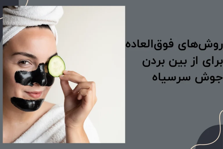 روش‌ های فوق‌ العاده برای از بین بردن جوش سر سیاه