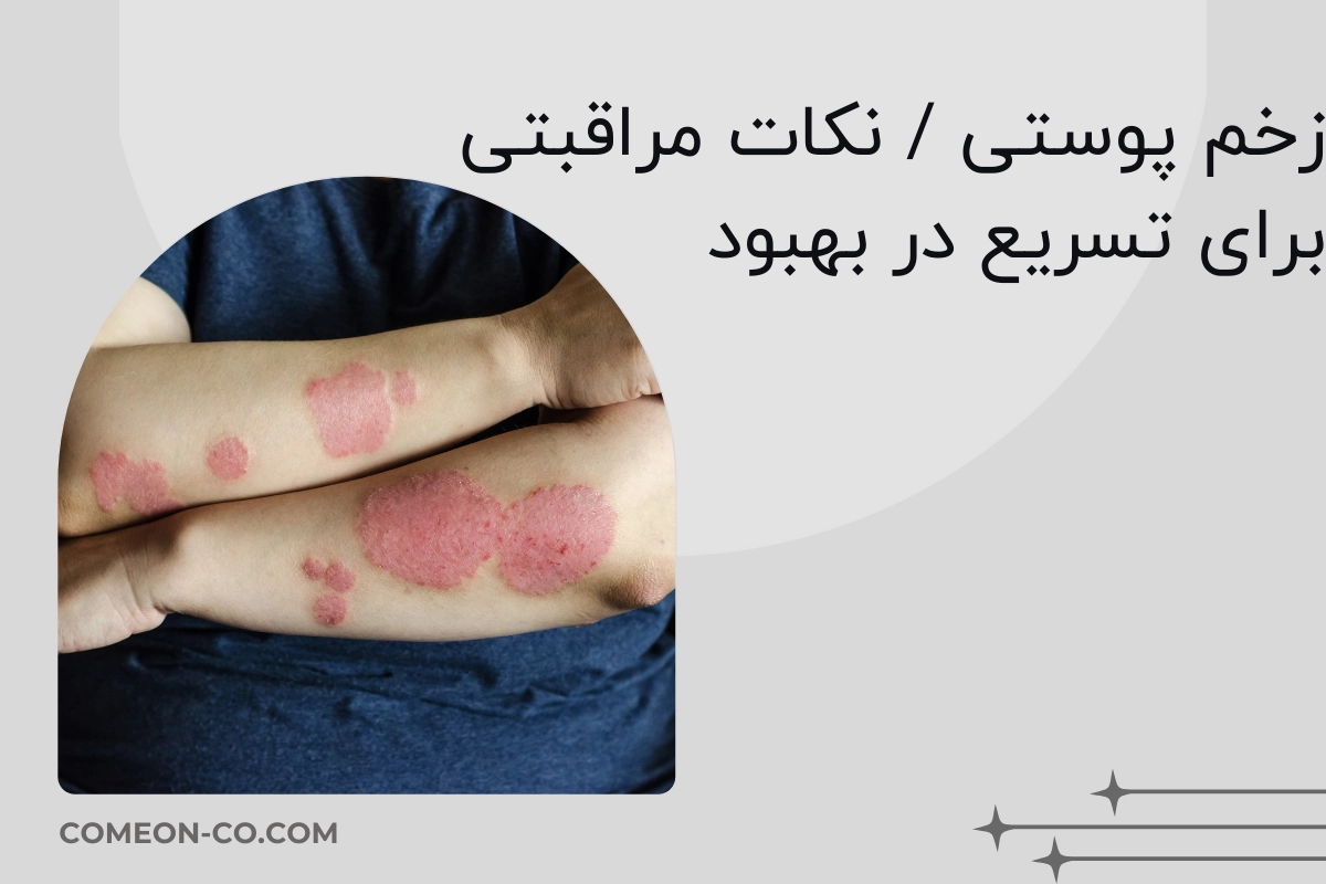 زخم پوستی / نکات مراقبتی برای تسریع در بهبود