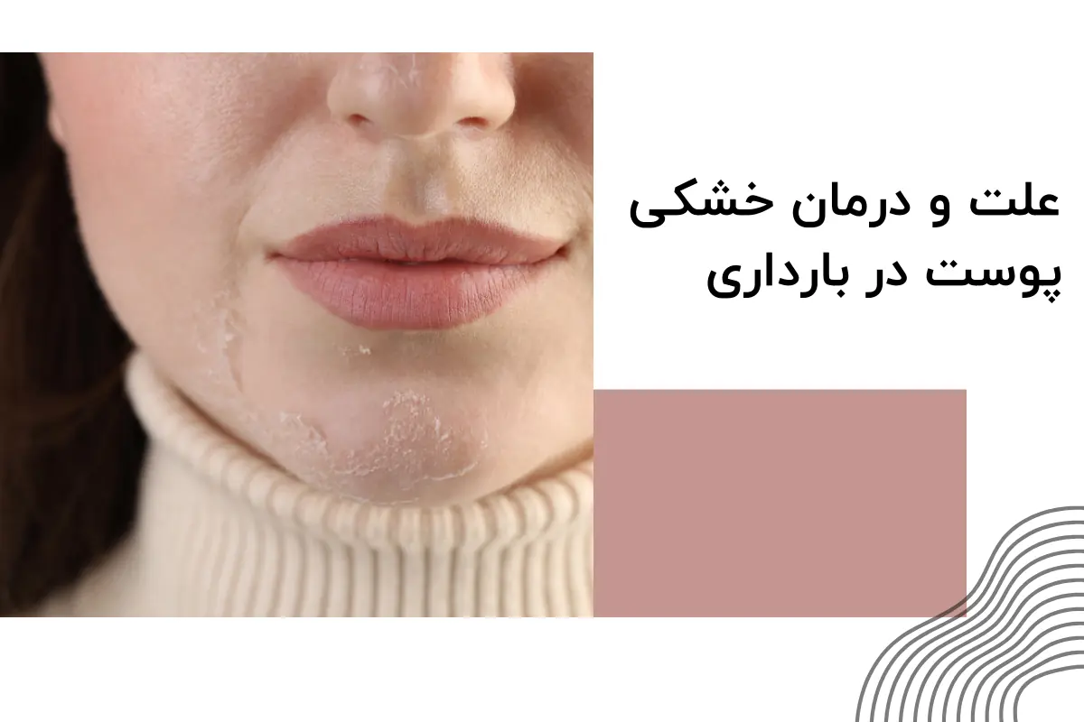 علت و درمان خشکی پوست در بارداری