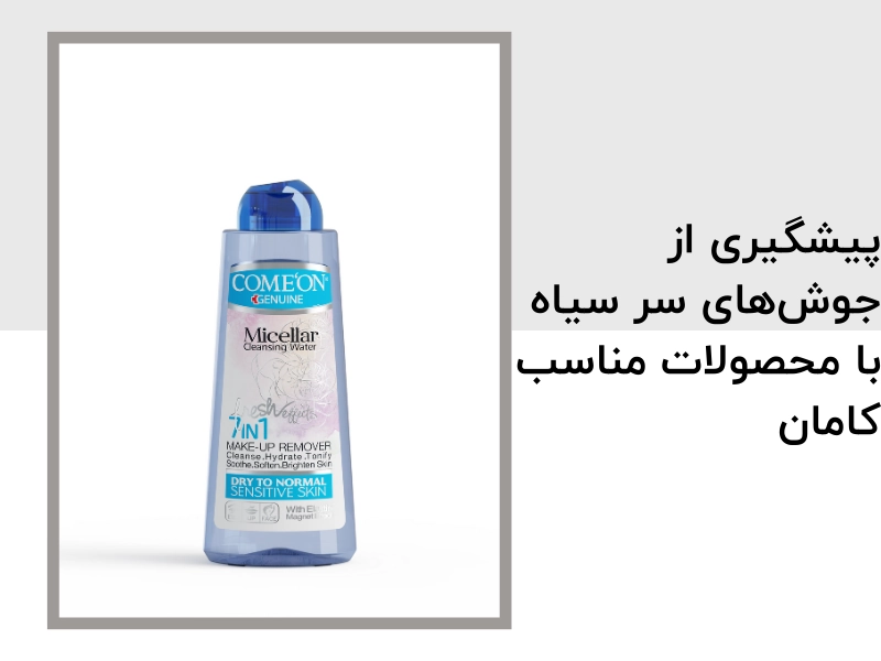 پیشگیری از جوش‌های سر سیاه با محصولات مناسب کامان