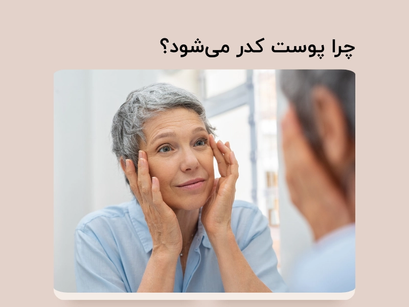 چرا پوست کدر می‌شود