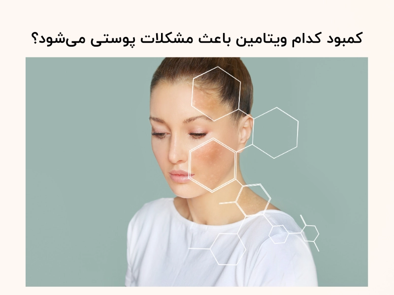 کمبود کدام ویتامین باعث مشکلات پوستی میشود؟