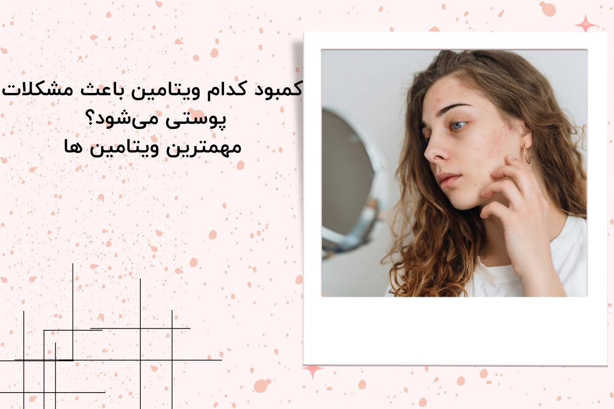 کمبود کدام ویتامین باعث مشکلات پوستی میشود؟ / مهمترین ویتامین ها