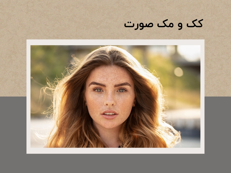 کک و مک صورت