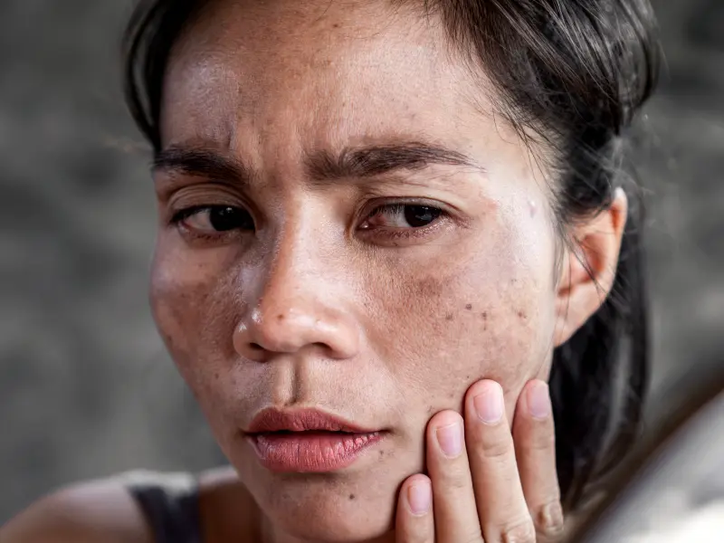 ترمیم و درمان سد دفاعی پوست آسیب دیده