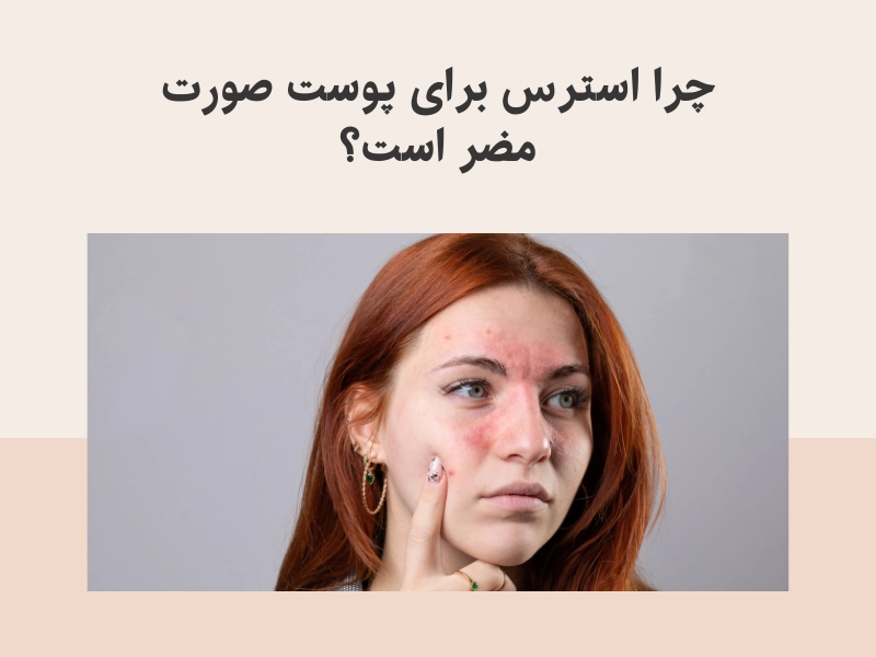 چرا استرس برای پوست صورت مضر است؟