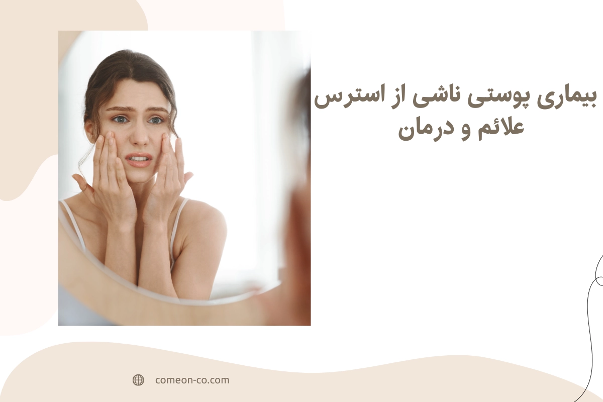 بیماری پوستی ناشی از استرس