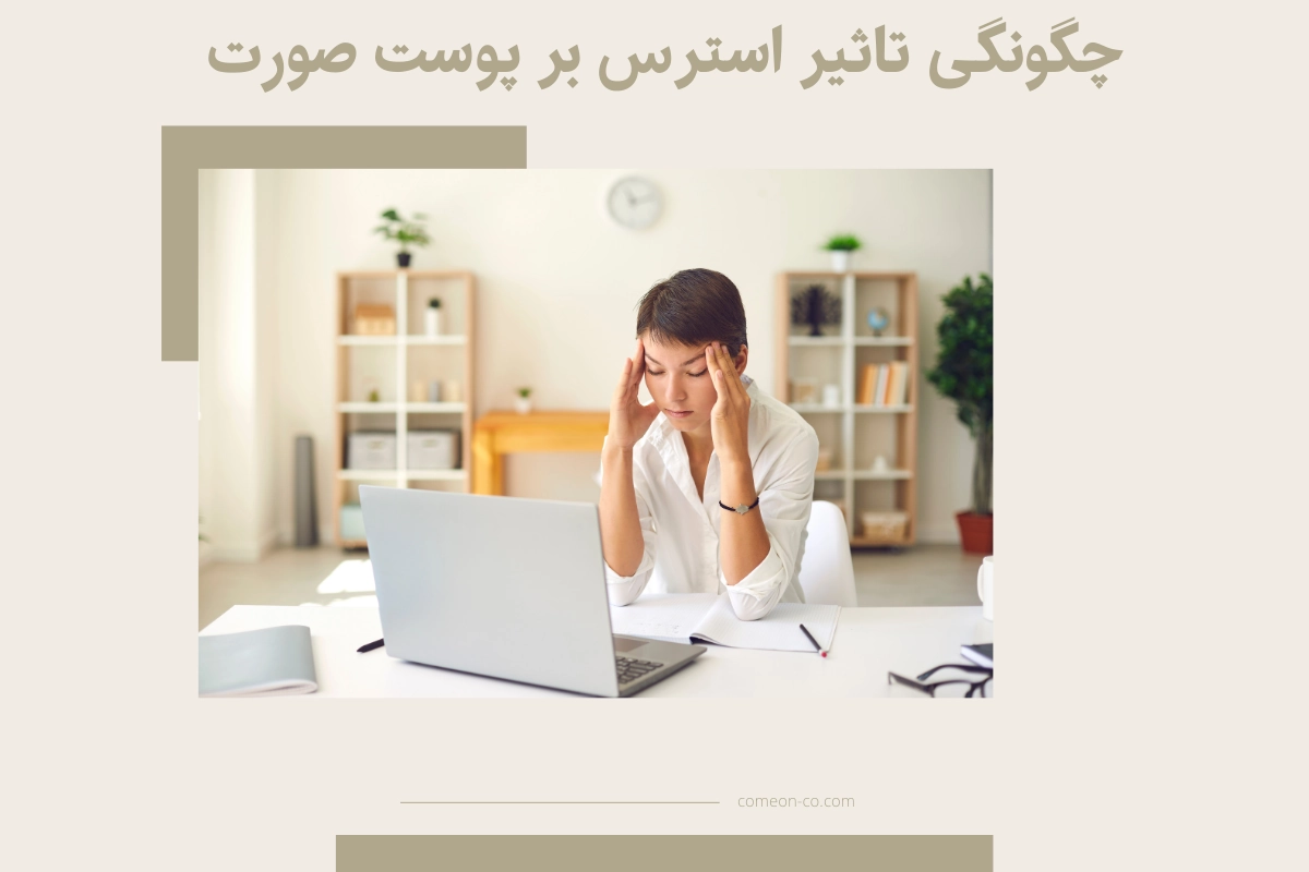 چگونگی تاثیر استرس بر پوست صورت