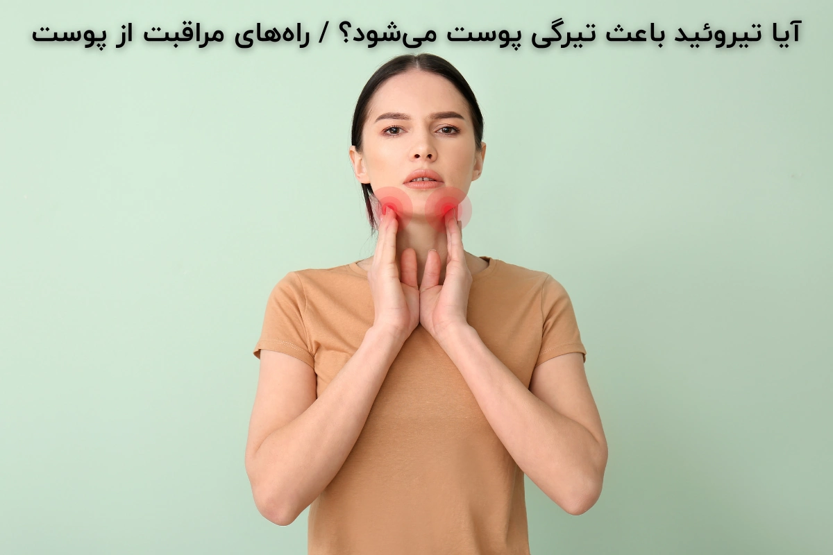 آیا تیروئید باعث تیرگی پوست میشود