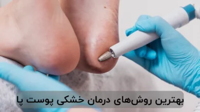 بهترین روشهای درمان خشکی پوست پا