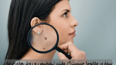 بیماری ملانوما چیست؟/ علت، تشخیص و روشهای درمان