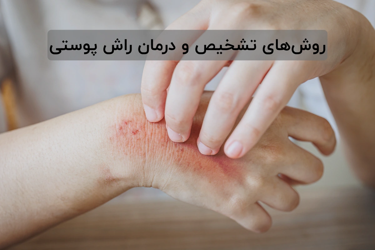 روش‌های تشخیص و ‌‌‌درمان ‌‌‌راش پوستی