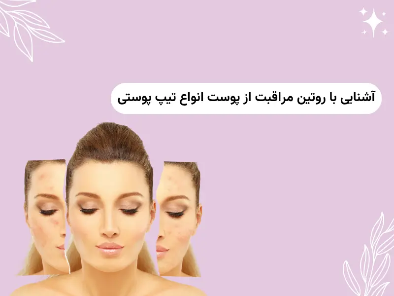 آشنایی با روتین مراقبت از پوست انواع تیپ پوستی